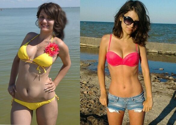 Anna ha perso 10 kg con NexaSlim